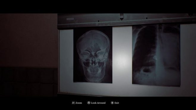 Zoe is shown looking at some x-rays in Silent Hill Townfall.